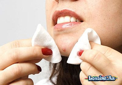 Sızanaqlara qarşı necə mübarizə aparmaq olar? - LoaDinG.Az