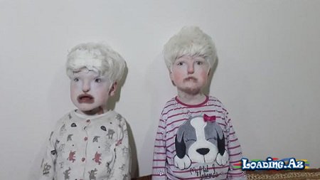 Danışmır, eşitmir, qəribə səslər çıxarırlar... - Hamı bu uşaqlardan danışır - FOTOLAR