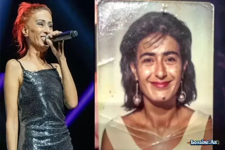 Yıldız Tilbedən illər sonra ETİRAF: “Uşaqlıqda qulağımı itirdim”